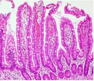 Healthy intestinal surface     