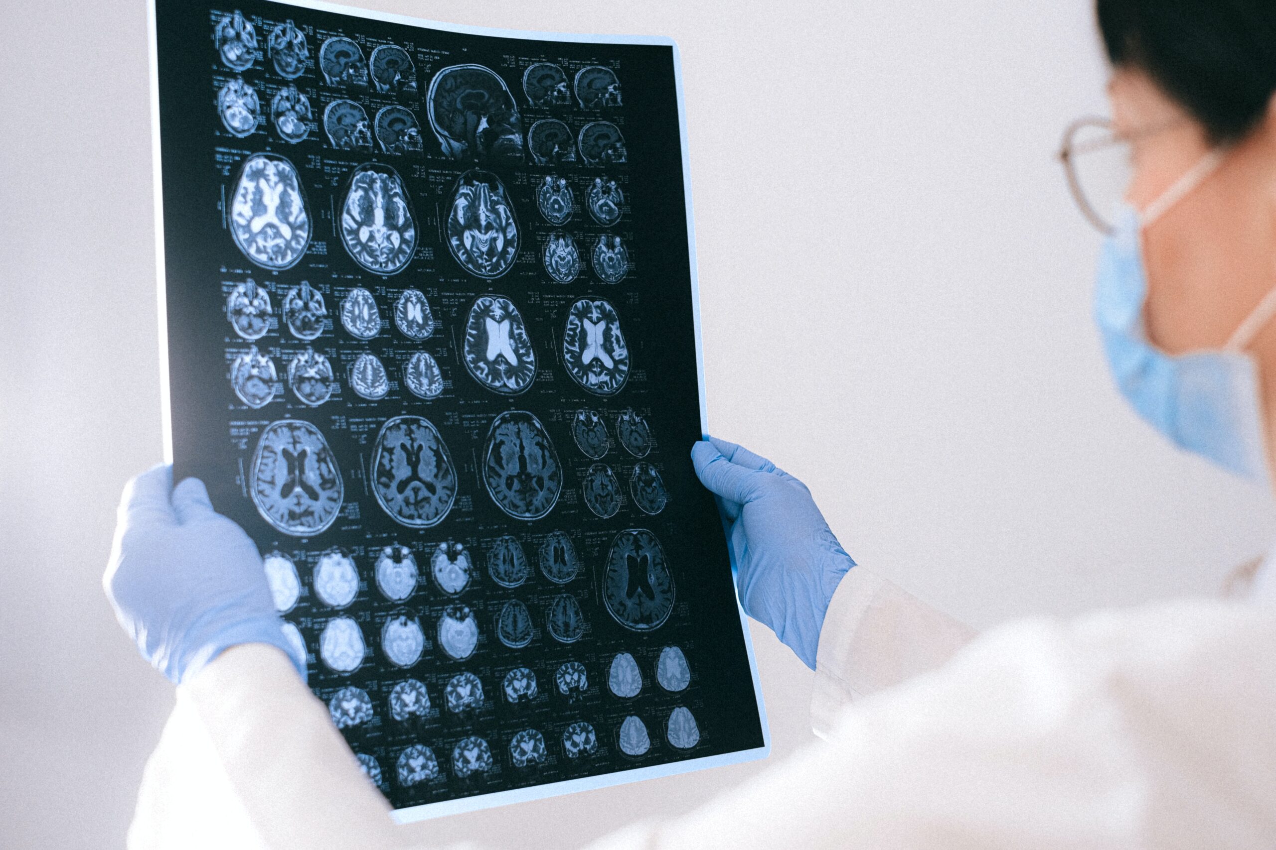 The Surprising Truth About Neurological Symptoms (You Need To Know This!) - py8xqko
